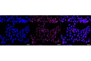 Immunocytochemical staining of HAP-1 cells with GST3 / GSTP1 antibody (ABIN7798758), 1:1,000). (Rekombinanter GSTP1 Antikörper)