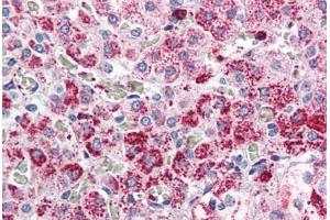 Adrenal, Human: Formalin-Fixed, Paraffin-Embedded (FFPE) (CCKAR Antikörper  (Internal Region))