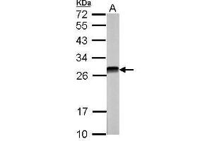 WB Image Sample (30 ug of whole cell lysate) A: NIH-3T3 12% SDS PAGE antibody diluted at 1:5000 (CSNK2B Antikörper)