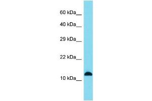 Host: Rabbit Target Name: SPANXB1 Sample Type: A549 Whole Cell lysates Antibody Dilution: 1. (SPANXB1 Antikörper  (Middle Region))