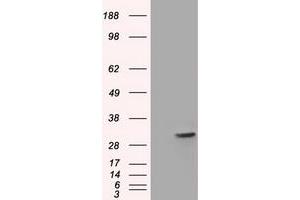 Western Blotting (WB) image for anti-Four and A Half LIM Domains 1 (FHL1) antibody (ABIN1500976) (FHL1 Antikörper)