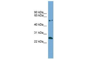 WB Suggested Anti-ETHE1 Antibody Titration: 0. (ETHE1 Antikörper  (Middle Region))