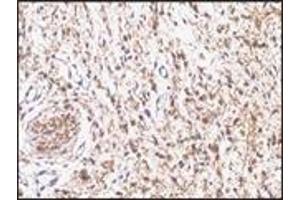 Immunohistochemistry (IHC) image for anti-S-100 (C-Term) antibody (ABIN870449) (S-100 Antikörper  (C-Term))