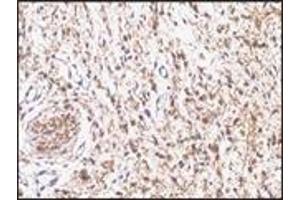 Immunohistochemistry (IHC) image for anti-S-100 (C-Term) antibody (ABIN870446)