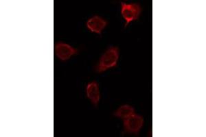 ABIN6276899 staining NIH-3T3 by IF/ICC.