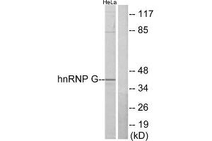 Western Blotting (WB) image for anti-RNA Binding Motif Protein, X-Linked (RBMX) (N-Term) antibody (ABIN1849344) (RBMX Antikörper  (N-Term))