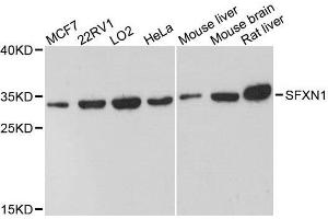 Western blot analysis of extracts of various cell lines, using SFXN1 antibody. (SFXN1 Antikörper  (AA 87-322))