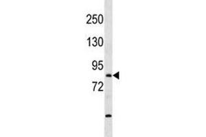 TBR1 antibody western blot analysis in mouse bladder tissue lysate (TBR1 Antikörper  (AA 52-80))