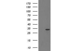 HEK293T cells were transfected with the pCMV6-ENTRY control (Left lane) or pCMV6-ENTRY HDHD2 (Right lane) cDNA for 48 hrs and lysed. (HDHD2 Antikörper)