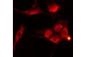 ABIN6276416 staining  Hela cells by IF/ICC. (TRAF2 Antikörper  (C-Term))