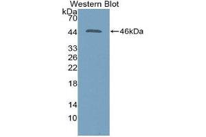 Western Blotting (WB) image for anti-Sialidase 1 (Lysosomal Sialidase) (NEU1) (AA 47-415) antibody (ABIN3201608) (NEU1 Antikörper  (AA 47-415))