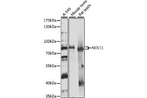Western blot analysis of extracts of various cell lines, using NOL11 antibody (ABIN7269032) at 1:1000 dilution.