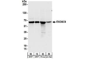 Western Blotting (WB) image for anti-Exosome Component 9 (EXOSC9) (AA 389-439) antibody (ABIN7450230)