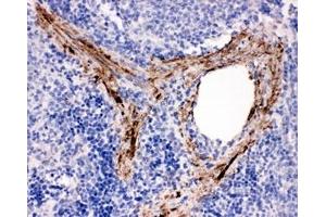 Immunohistochemistry (IHC) image for anti-ADAM Metallopeptidase Domain 19 (Adam19) (N-Term) antibody (ABIN3029861)