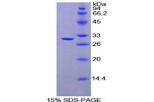 SDS-PAGE analysis of Chicken Carbonic Anhydrase II Protein.