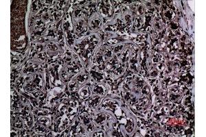 Immunohistochemistry (IHC) analysis of paraffin-embedded Human Breast, antibody was diluted at 1:100.