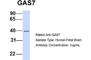 Host:  Rabbit  Target Name:  GAS7  Sample Type:  Human Fetal Brain  Antibody Dilution:  1. (GAS7 Antikörper  (N-Term))