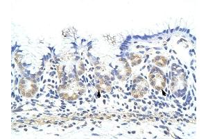 ZNF322A antibody was used for immunohistochemistry at a concentration of 4-8 ug/ml to stain Epithelial cells of fundic gland (arrows) in Human Stomach.