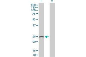 Western Blotting (WB) image for anti-NADH Dehydrogenase (Ubiquinone) Fe-S Protein 8, 23kDa (NADH-Coenzyme Q Reductase) (NDUFS8) (AA 1-210) antibody (ABIN518265)
