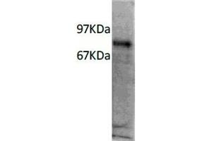 Western Blotting (WB) image for anti-Interleukin 7 Receptor (IL7R) antibody (ABIN6923149) (IL7R Antikörper)