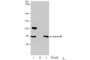 IP Image Immunoprecipitation of Lamin B1 protein from 293T whole cell extracts using 5 μg of Lamin B1 antibody, Western blot analysis was performed using Lamin B1 antibody, EasyBlot anti-Rabbit IgG  was used as a secondary reagent.