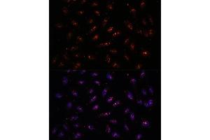 Immunofluorescence analysis of U-2 OS cells using DNTTIP2 antibody (ABIN7266732) at dilution of 1:100. (DNTTIP2 Antikörper  (AA 1-300))