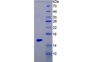 Image no. 1 for Interleukin 17 (IL17) (AA 22-158) protein (His tag) (ABIN4988290) (IL-17 Protein (AA 22-158) (His tag))