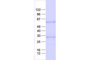 Validation with Western Blot (MKNK2 Protein (His tag))