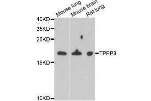 Western blot analysis of extracts of various cell lines, using TPPP3 antibody. (TPPP3 Antikörper)