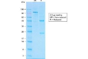 SDS-PAGE Analysis of Purified CD20 Rabbit Recombinant Monoclonal Antibody (IGEL/1497R). (Rekombinanter CD20 Antikörper)