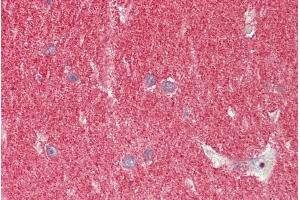 ABIN1049516 (5µg/ml) staining of paraffin embedded Human Cerebellum. (SNCA Antikörper  (Internal Region))