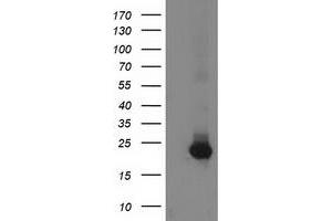 Western Blotting (WB) image for anti-Guanylate Kinase 1 (GUK1) antibody (ABIN1498566)