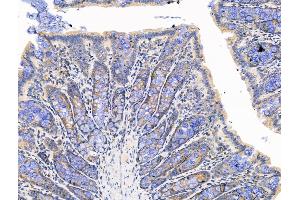 ABIN7094540 and ABIN7098589 at 1/100 staining Rat colorectal tissue by IHC-P.