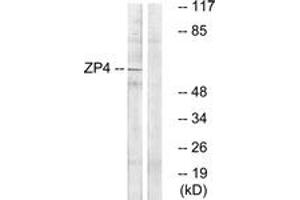 Western blot analysis of extracts from Jurkat cells, using ZP4 Antibody. (ZP4 Antikörper  (AA 231-280))