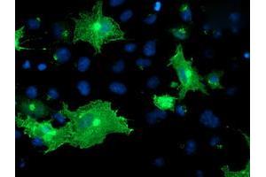 Anti-OSBP mouse monoclonal antibody (ABIN2454755) immunofluorescent staining of COS7 cells transiently transfected by pCMV6-ENTRY OSBP (RC204250). (OSBP Antikörper)