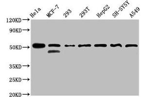 Western Blot Positive WB detected in: Hela whole cell lysate, MCF-7 whole cell lysate, 293 whole cell lysate, 293T whole cell lysate, HepG2 whole cell lysate, SH-SY5Y whole cell lysate, A549 whole cell lysate All lanes: PLAGL1 antibody at 3 μg/mL Secondary Goat polyclonal to rabbit IgG at 1/50000 dilution Predicted band size: 51, 45 kDa Observed band size: 51 kDa (PLAGL1 Antikörper  (AA 326-381))