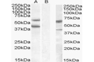 Image no. 5 for anti-Diacylglycerol O-Acyltransferase 2 (DGAT2) (Internal Region) antibody (ABIN190849)