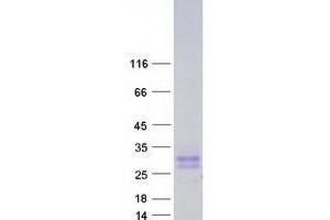 Validation with Western Blot (CD99L2 Protein (Transcript Variant 4) (Myc-DYKDDDDK Tag))