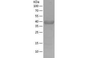 Western Blotting (WB) image for Salt-Inducible Kinase 2 (SIK2) (AA 827-926) protein (His-IF2DI Tag) (ABIN7124981) (SIK2 Protein (AA 827-926) (His-IF2DI Tag))