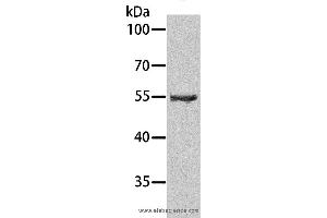 Western blot analysis of Human testis tissue, using SPATA6 Polyclonal Antibody at dilution of 1:1000 (SPATA6 Antikörper)