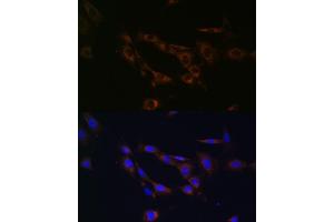 Immunofluorescence (IF) image for anti-ATP-Binding Cassette, Sub-Family A (ABC1), Member 1 (ABCA1) (AA 1870-2120) antibody (ABIN7265726)