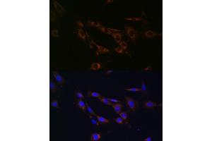Immunofluorescence analysis of NIH/3T3 cells using  Rabbit pAb (ABIN7265726) at dilution of 1:100 (40x lens). (ABCA1 Antikörper  (AA 1870-2120))