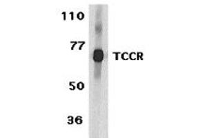 Western Blotting (WB) image for anti-Interleukin 27 Receptor, alpha (IL27RA) (N-Term) antibody (ABIN1031603)