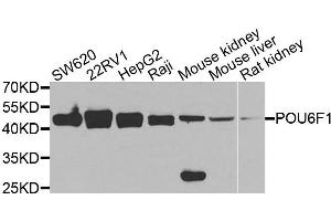 Western blot analysis of extracts of various cell lines, using POU6F1 antibody. (POU6F1 Antikörper  (AA 1-301))