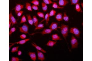 IF analysis of SMAD2 using anti-SMAD2 antibody (ABIN6719361). (SMAD2 Antikörper  (AA 83-264))