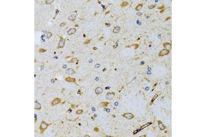 Immunohistochemistry of paraffin-embedded mouse brain using SRP19 antibody (ABIN2560139) at dilution of 1:100 (40x lens). (SRP19 Antikörper)