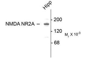 Image no. 1 for anti-Glutamate Receptor, Ionotropic, N-Methyl D-Aspartate 2a (GRIN2A) (C-Term) antibody (ABIN372679) (NMDAR2A Antikörper  (C-Term))