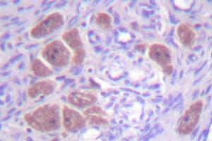 Image no. 1 for anti-Neutrophil Cytosolic Factor 4, 40kDa (NCF4) antibody (ABIN272048) (NCF4 Antikörper)