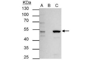 IP Image ERR alpha antibody immunoprecipitates ERR alpha protein in IP experiments. (ESRRA Antikörper)