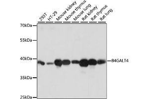 Western blot analysis of extracts of various cell lines, using B4G antibody (ABIN7271200) at 1:1000 dilution. (B4GALT4 Antikörper  (AA 35-344))